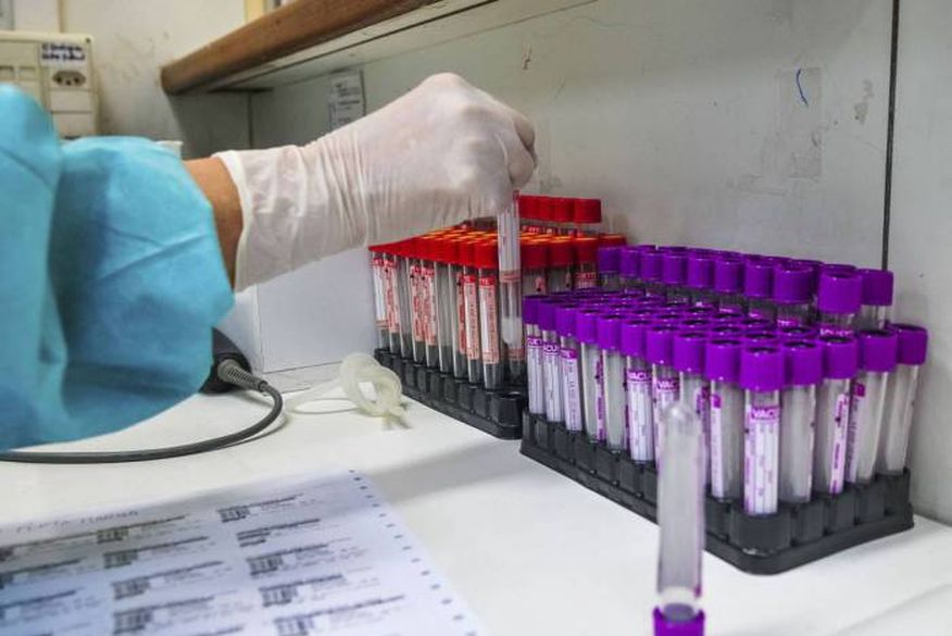 Paraíba confirma 1.028 novos casos de Covid-19 e 12 óbitos nesta quinta; total de mortos chega a 3.857 e 175.227 infectados
