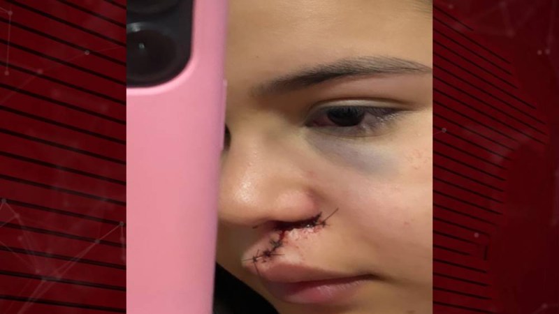 Jovem é agredida após recusar dança com homem