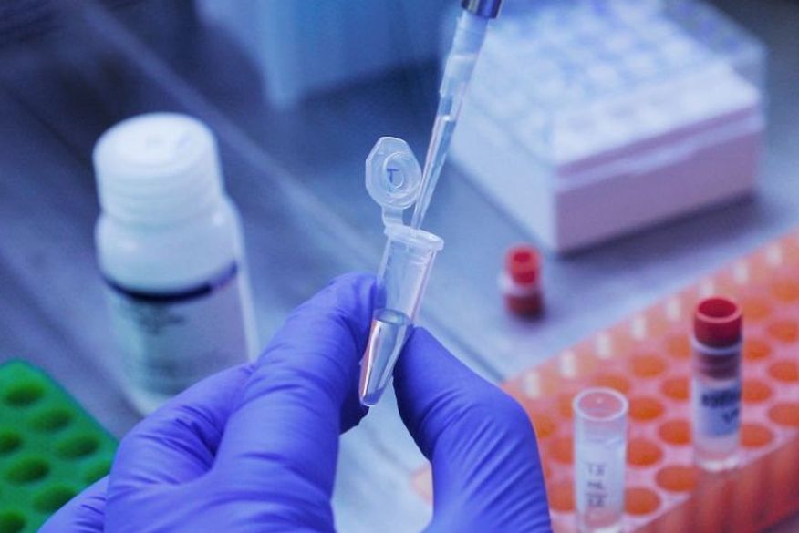 Brasil tem primeira morte confirmada pela variante ômicron da Covid-19