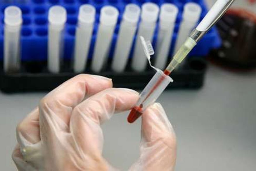 Mulher é curada do HIV após transplante de células-tronco