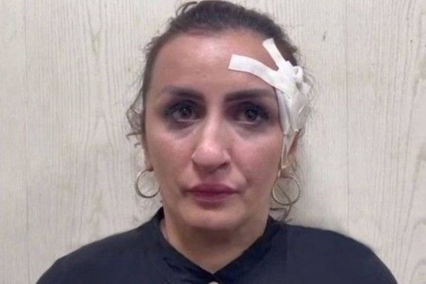 Mulher vende seu bebê por R$ 17,5 mil para financiar plástica no nariz