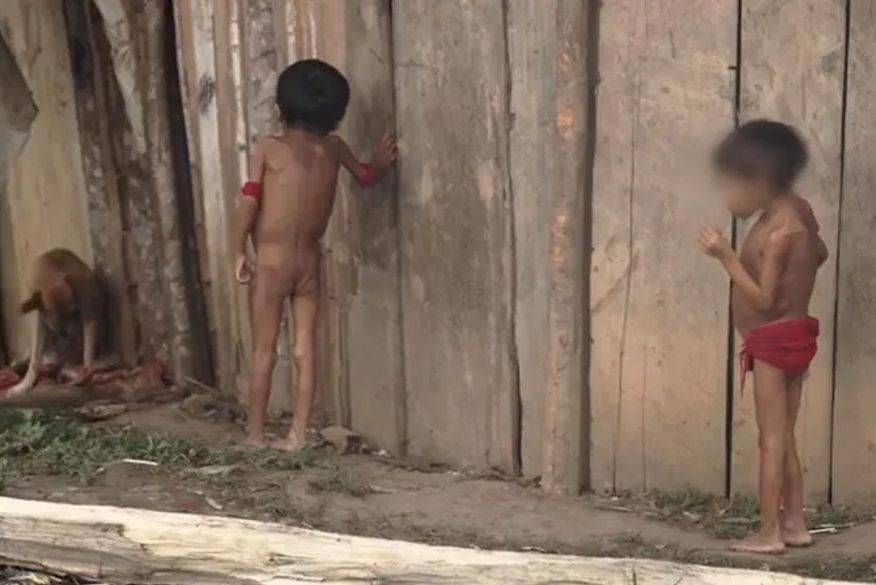 Desnutrição atinge cerca de 50% de crianças Yanomami de até 5 anos monitoradas pelo SUS